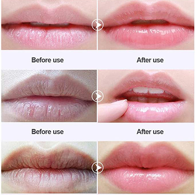 Custom Vegan Anti Wrinkle Konjac Lip Patch Cruelty Free